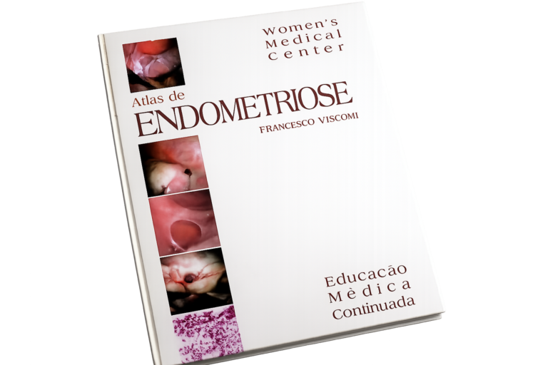 endometriose